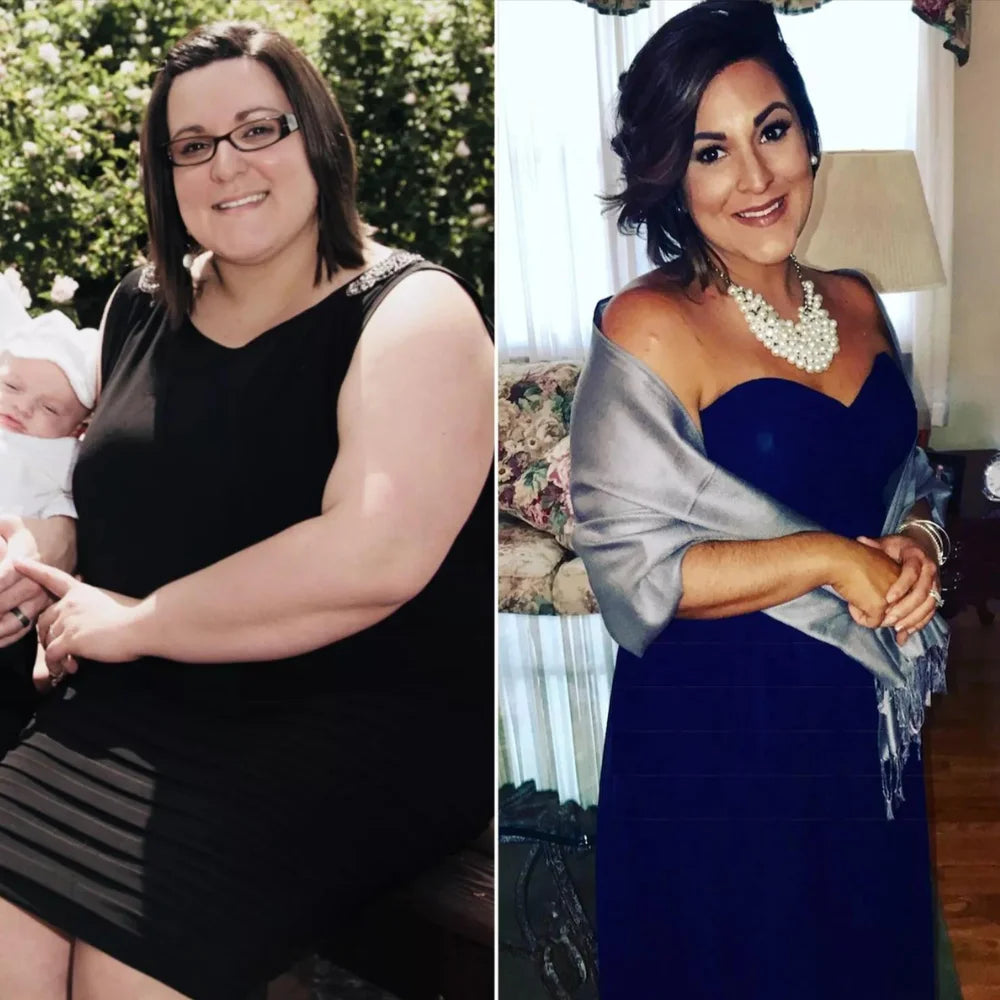 Before/After 1