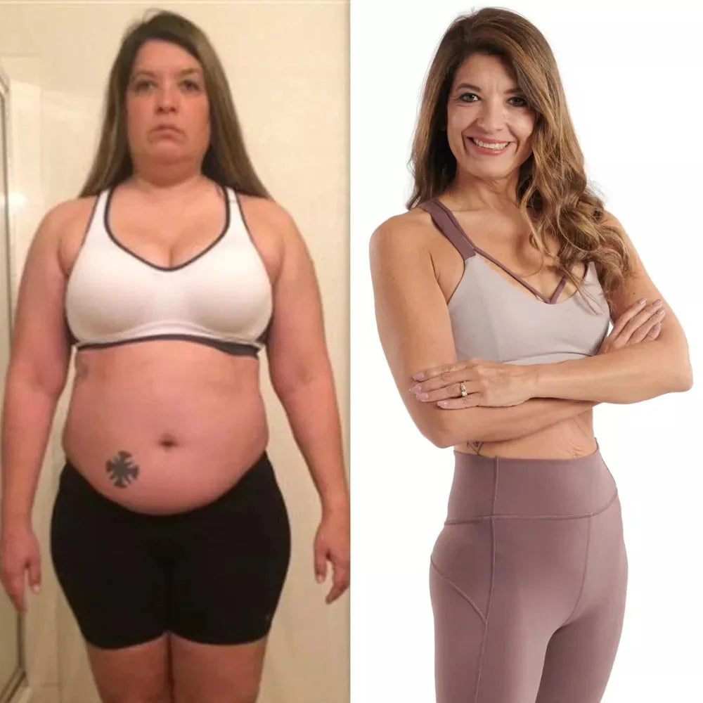 Before/After 2