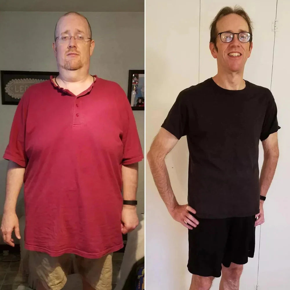 Before/After 5