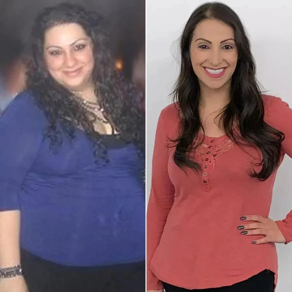 Before/After 6
